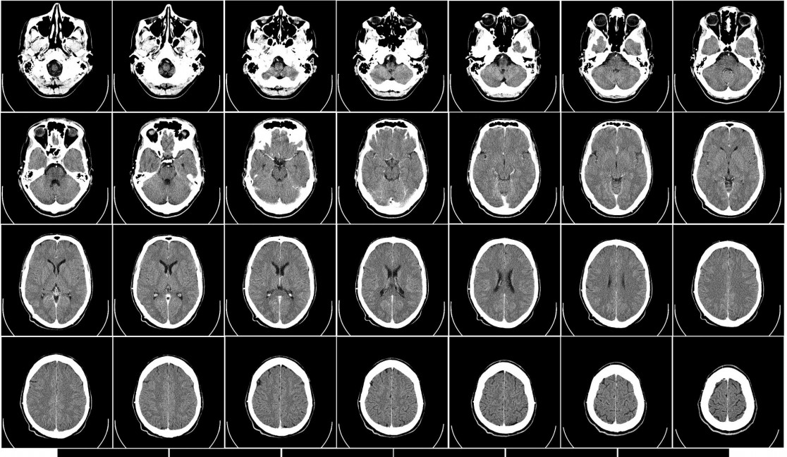 #328 Povídání o tom, no víte, jak se to jmenuje